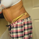 3 Days Post Opt.
