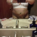 Post Op 2 Days...very swollen:)