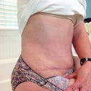 Scar and fat thighs!