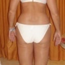 Before - back