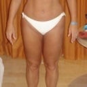 Before - front