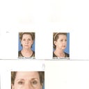 Before pictures