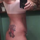 Rt side view 4 wk.  still have swelling