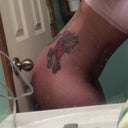 Rt side bent over 4 wk