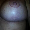 Left Breast 4 wk