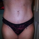 panties covering scar.  4wk