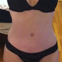 Almost 11 weeks post op. Looking pretty hot in my sexy underwear!