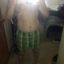 Pre-op full body