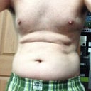 Pre-op torso (slightly bending over)