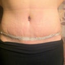 Looking much better! Still lots of swelling