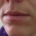 Lips Before
