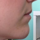 Lips Before (so flat on my upper lip. i really want some definition!)