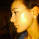 2.5 weeks after surgery
(not a huge dramatic difference but the tip is def. shorter)
**Flash makes me look orange**