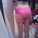 3 months post op.