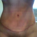 6 weeks