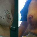 Before and after