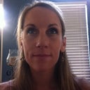 2 weeks post op - swelling subsiding and looking better each day!