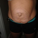 Pre-Op Front Shot