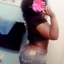 2 WEEKS POST OP AND I FEEL AMAZING STILL SWOLLEN BUT ITS GETTING BETTER DAY BY DAY