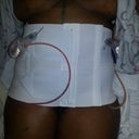 front view.... few hours post op