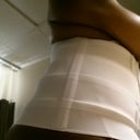 side view... few hours post op