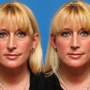 Front simulation photo of before and what could be