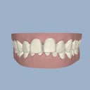 Pre- invisalign