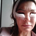 day one out of hospital .23 rd may2012