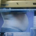 DAY OF SURGERY