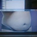 DAY OF SURGERY