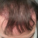 Hair pulled down.
