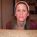 This was last night right after the treatment