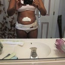 23 days post op and still looking the same as 3 days p o