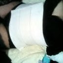This is how I sleep: Original binder over flexees CG ...works wonders at controlling swelling