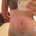 Bye-bye tattoo!