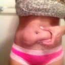 3wks after procedure