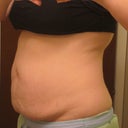 Before - side view