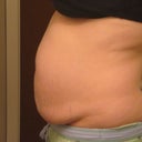 Before - Ugh!