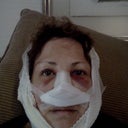 After surgery
