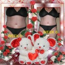WEEK'S 5 & 6 POST OP
