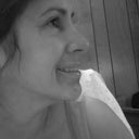 Day 17 PostOp view of right side of nose.  These are in black and white due to the discoloration of the chemical peel, but you can see my new nose is awesome!