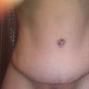 18 days after revision