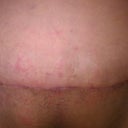 18 days after
