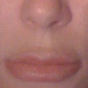 With fillers in lips