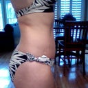 Side view at 6 weeks post op tt revision