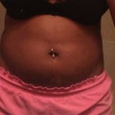 Front - 2 weeks before surgery