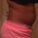 Side - 2 weeks before surgery
