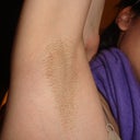 During my shower a lot of hair fell off on my underarms and this is a picture post the shower. (12-19-10)