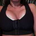 a couple hours post op..feeling like crap ;[ but LOVE how i dont have to wear a padded bra anymore! LOL :)