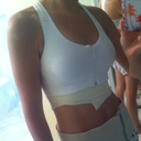 Post-Op 1 week